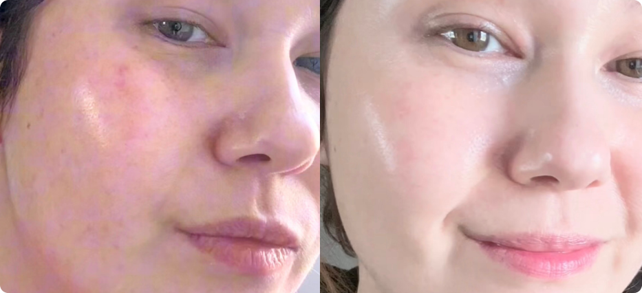 Before After