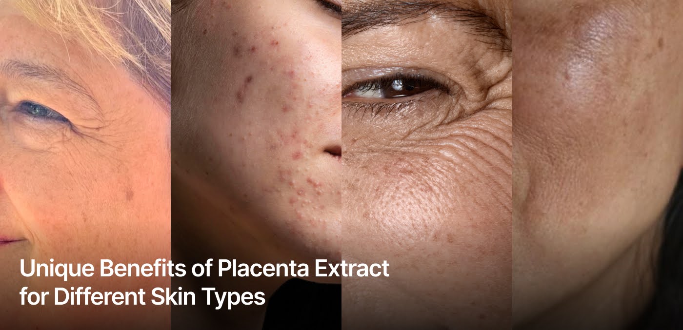 Unique Benefits of Placenta Extract for Different Skin Types