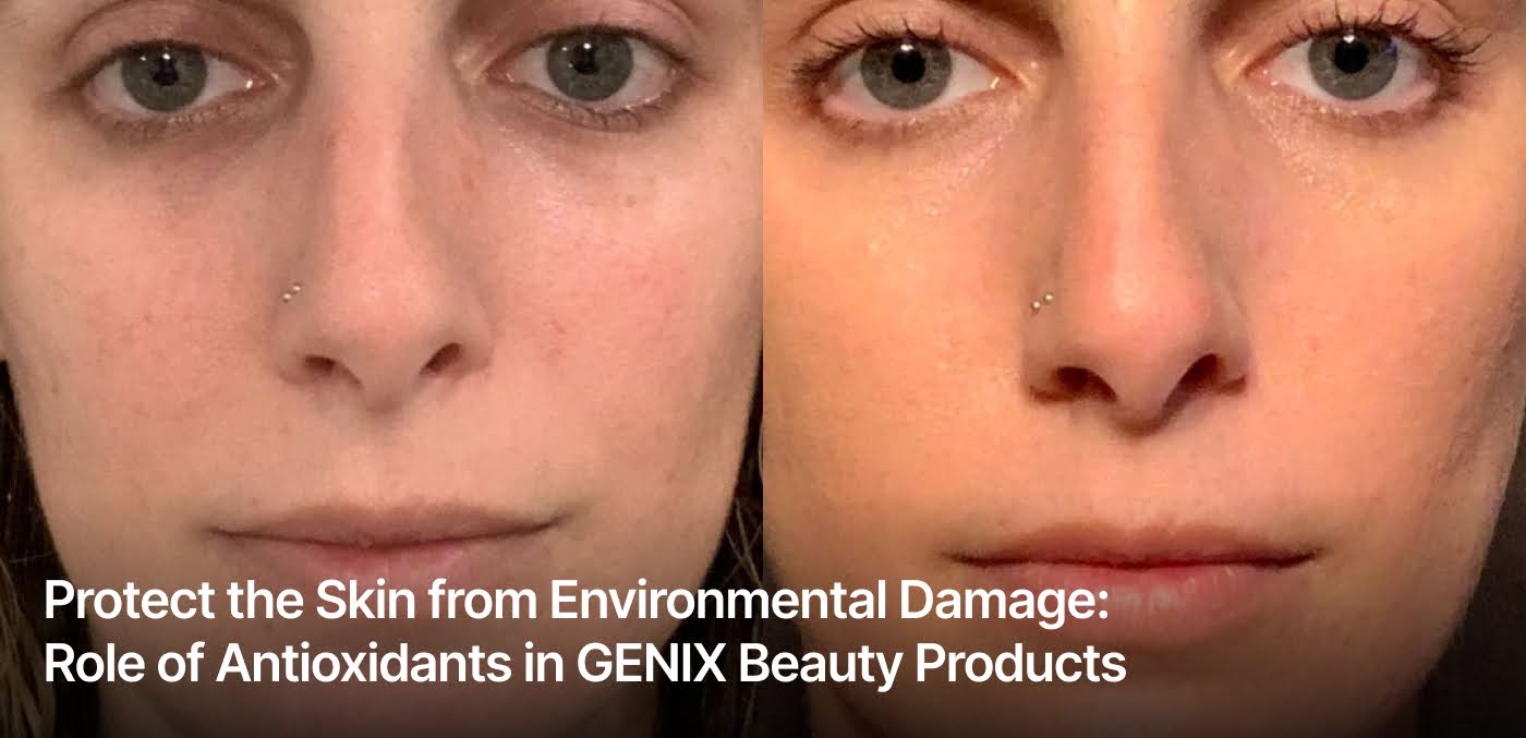 Protect the Skin from Environmental Damage: Role of Antioxidants in GENIX Beauty Products