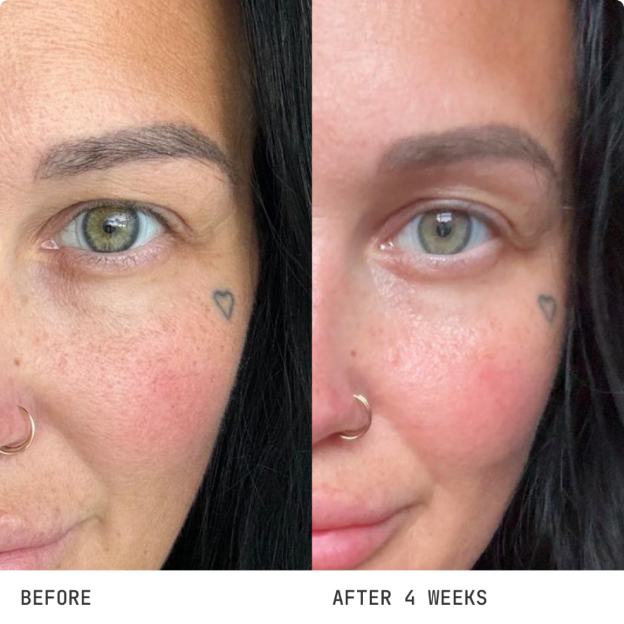 GENIX Beauty | Placenta Face Cream for Soft, Glowing Face Skin